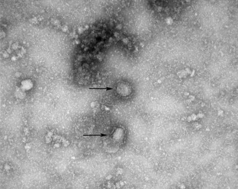 신종 코로나바이러스(코로나19) 전자현미경 사진. [출처 ": 질병관리본부]