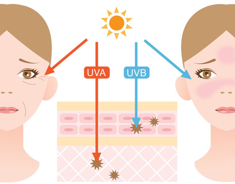 UVA와 UVB 피부층 흡수 정도. 출처 표준성형외과학 교과서